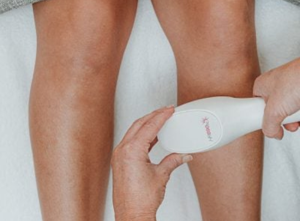 IPL HAIR REMOVAL